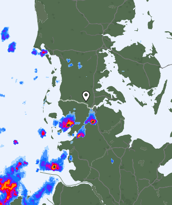 Radar
