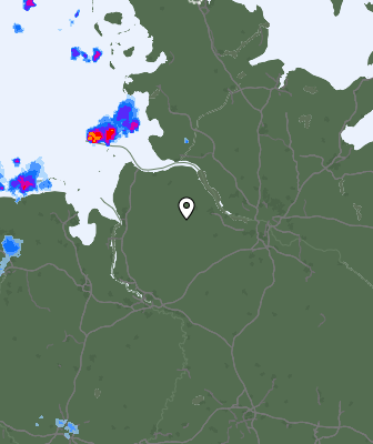 Radar