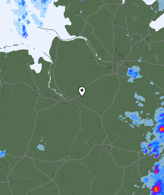 Radar