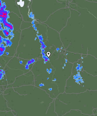Radar
