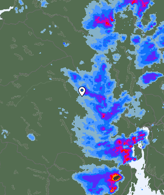 Radar