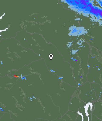 Radar