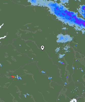 Radar