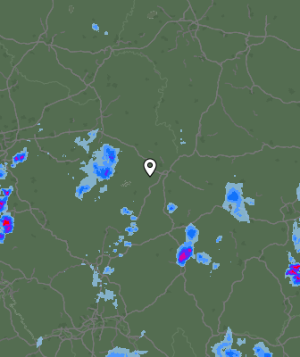 Radar