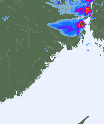 Radar