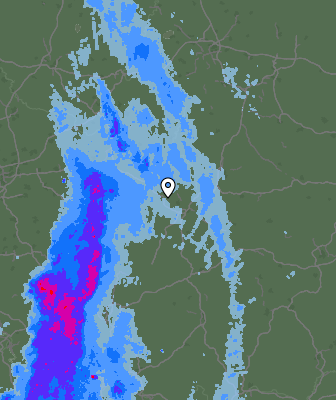Radar