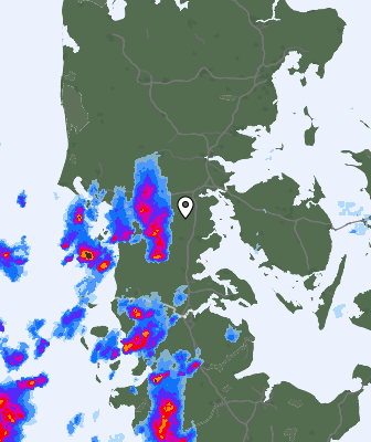 Radar