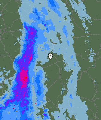 Radar