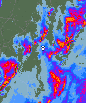 Radar