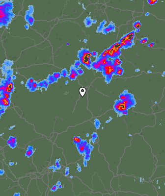 Radar