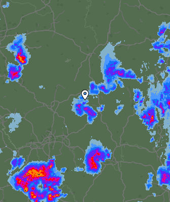 Radar