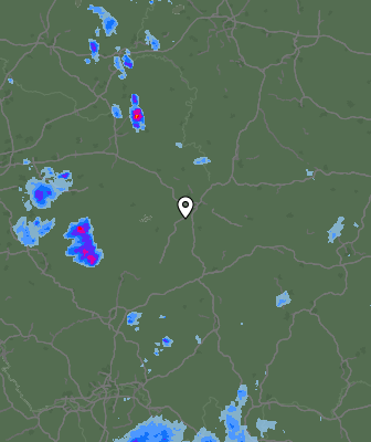 Radar