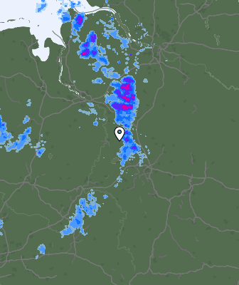 Radar