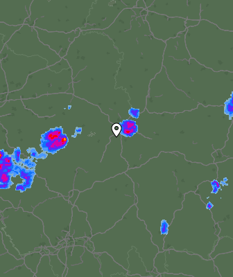 Radar
