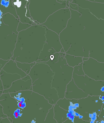 Radar