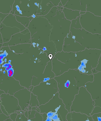 Radar