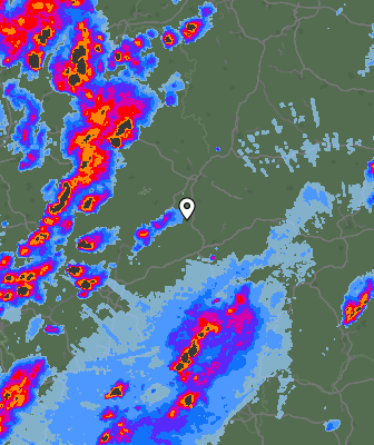 Radar