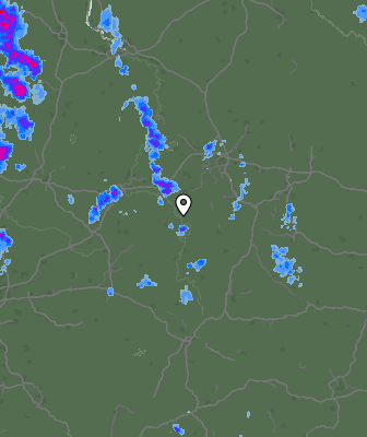 Radar