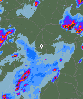 Radar
