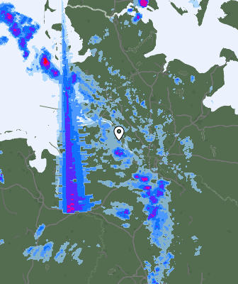 Radar