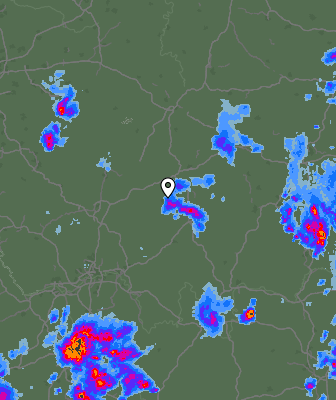 Radar
