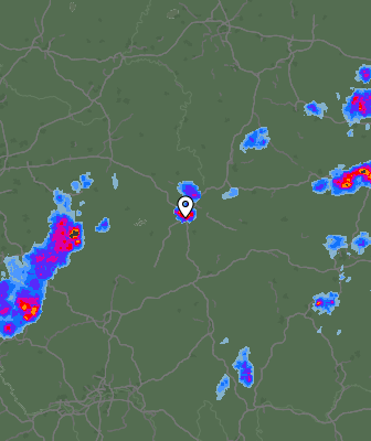 Radar