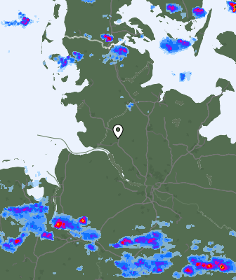 Radar