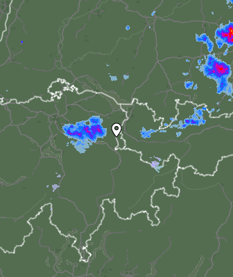 Radar