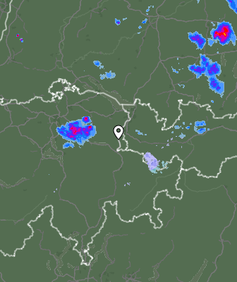 Radar