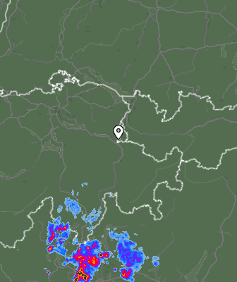 Radar