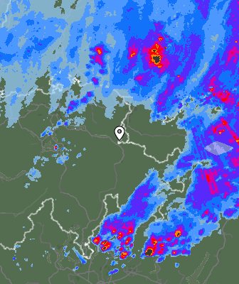 Radar