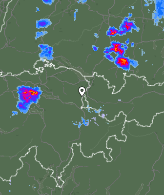 Radar