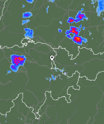 Radar