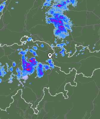 Radar