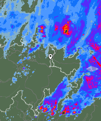 Radar