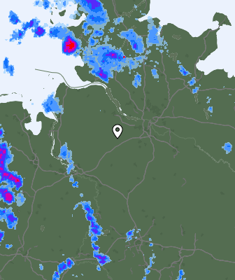 Radar