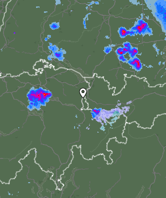Radar