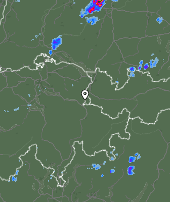 Radar