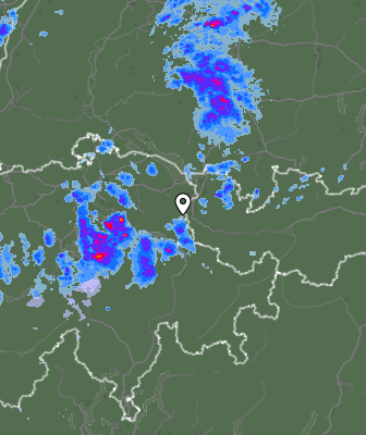 Radar