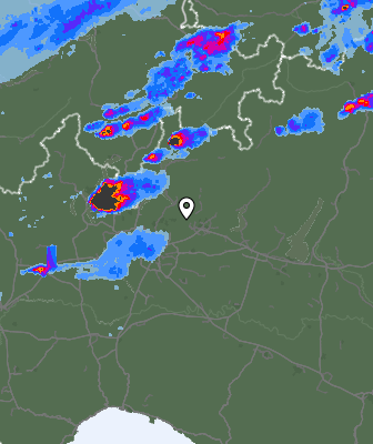 Radar