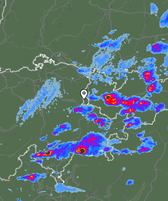 Radar