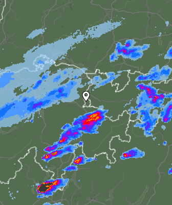 Radar