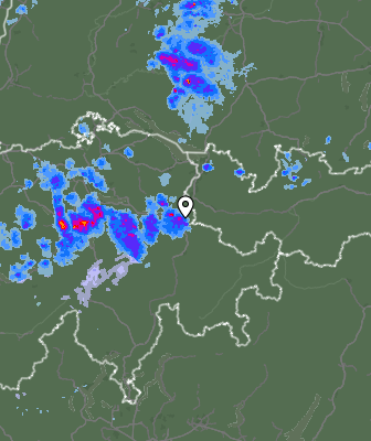 Radar