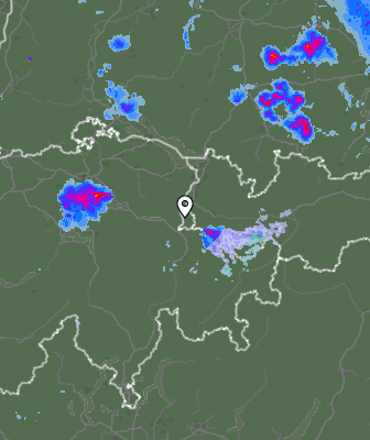 Radar