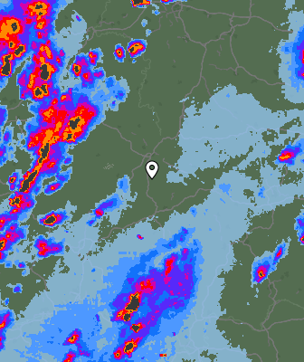 Radar