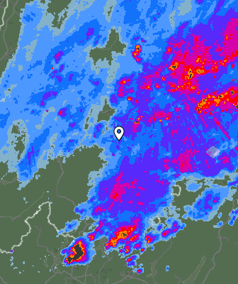Radar