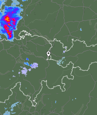 Radar