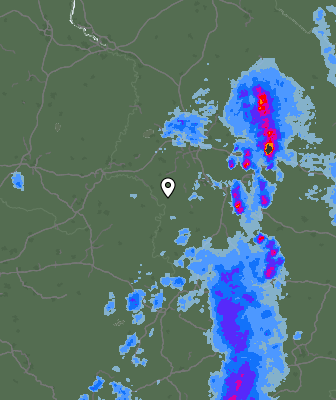 Radar