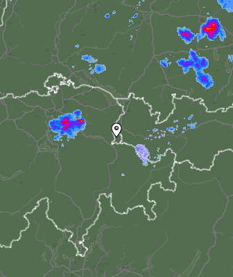 Radar