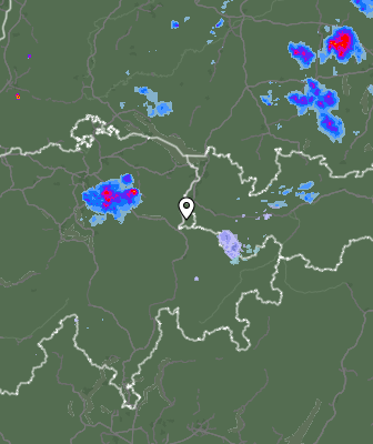 Radar